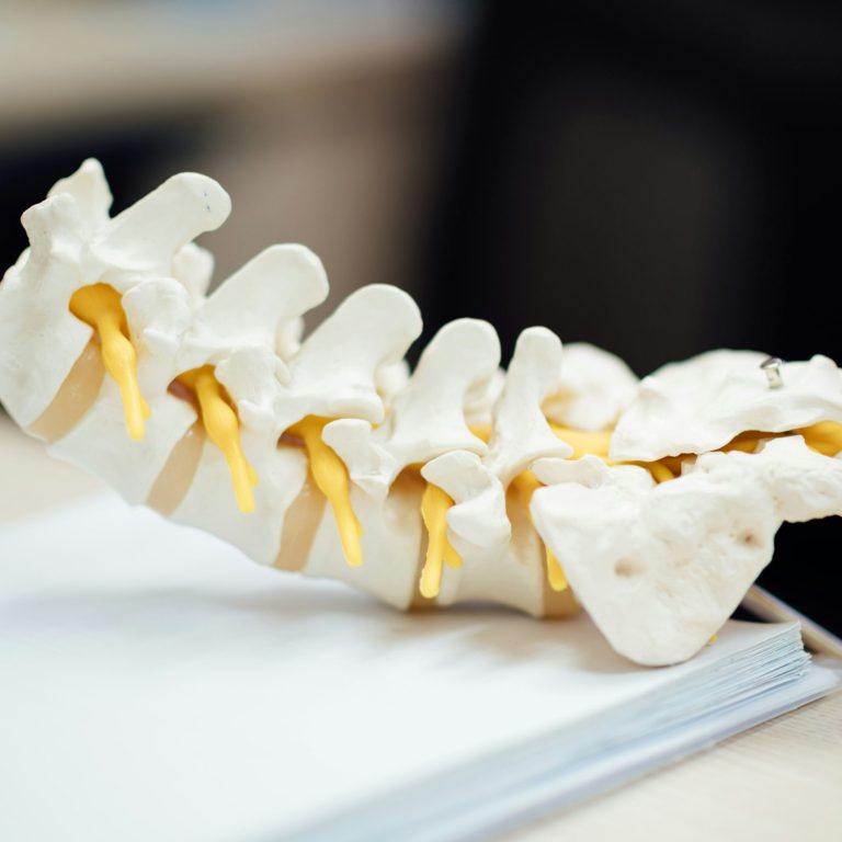 Village_Chiropractic_Manly_Australia_blog2